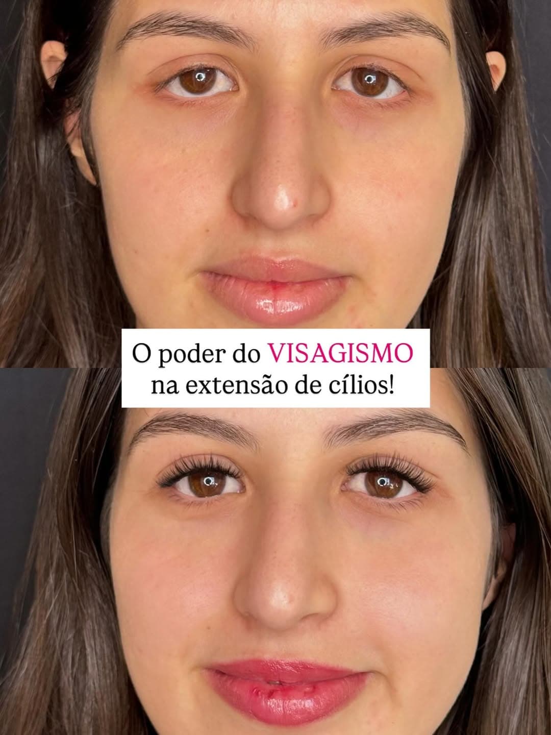 Antes e depois de extensão de cílios corrigindo pálpebra caída